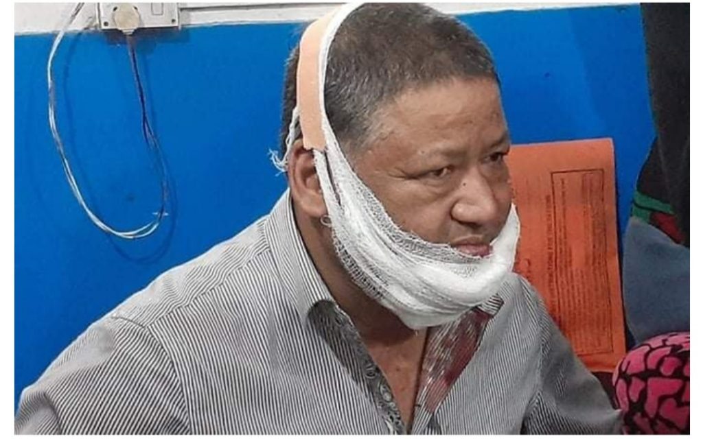 रूपन्देही क्षेत्र नम्बर २ को मतगणनास्थलमा देउवा-पौडेल समूहबीच कुटाकुट